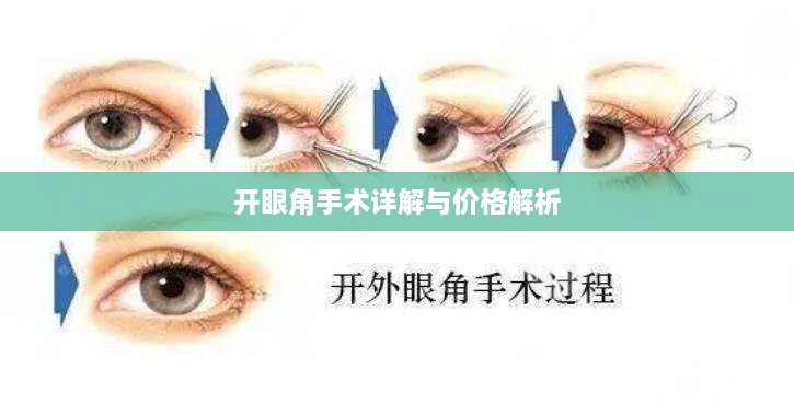 开眼角手术详解与价格解析