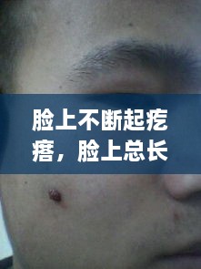 脸上不断起疙瘩，脸上总长疙瘩 
