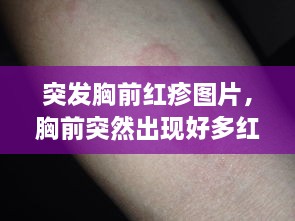 突发胸前红疹图片，胸前突然出现好多红疹不疼不痒 
